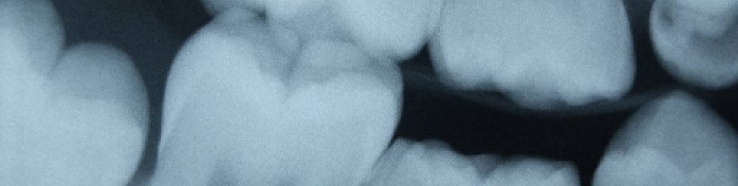 j0385814.jpg